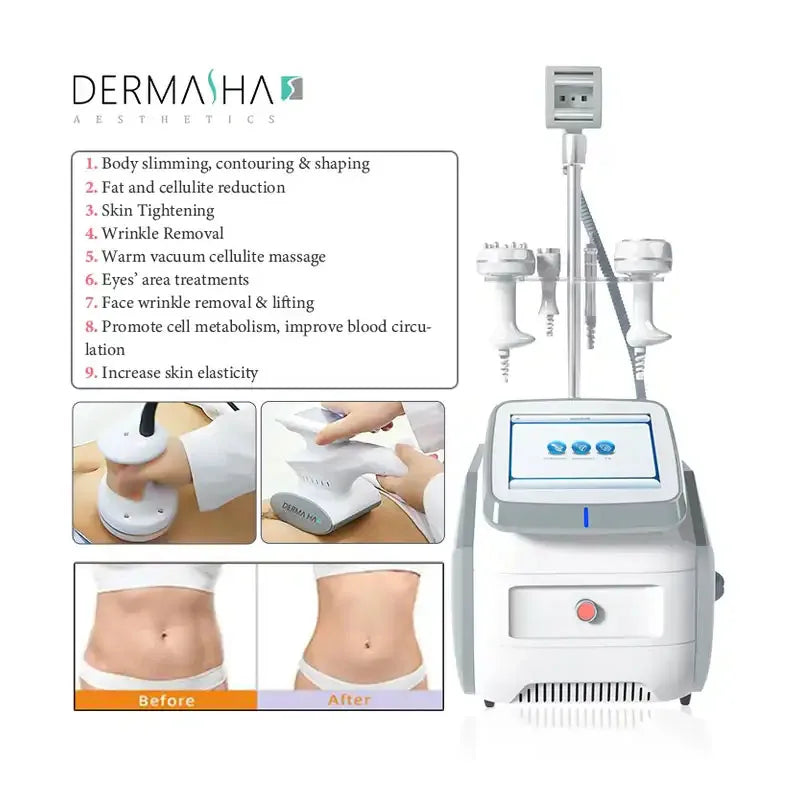 Vacuum Roller Massager for Body Sculpting & Weight Loss